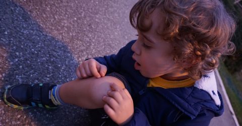 The child and the scratched knee