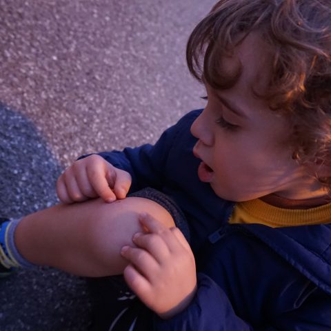 The child and the scratched knee