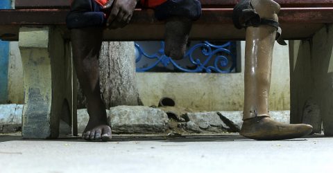 Man with one leg